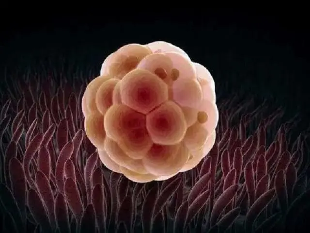 卵泡没排掉可以移植冻胚吗