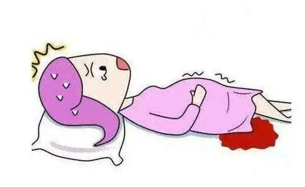 自我排除宫外孕的三个简单方法 自我排除宫外孕的三个简单方法