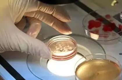 42岁做一代试管还是三代试管