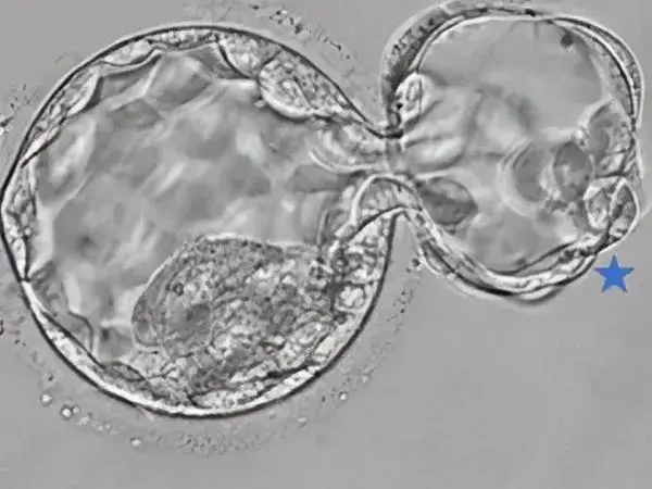 3ab囊胚相当于几级胚胎