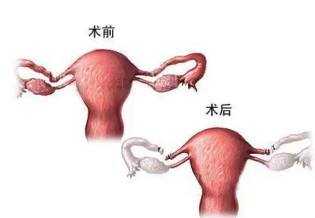 子宫切除做试管能怀孕吗