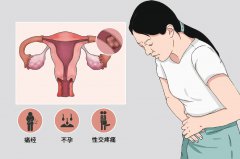 输卵管堵塞警示：身体发出的10大求救信号