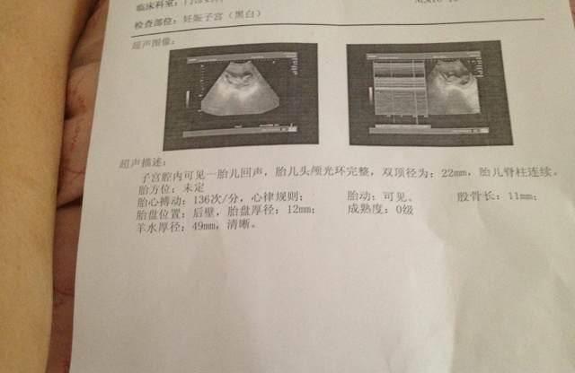 b超单子如何看是女儿还是儿子