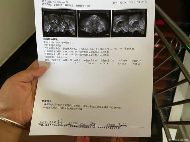 6个卵泡只配了2个胚胎正常吗