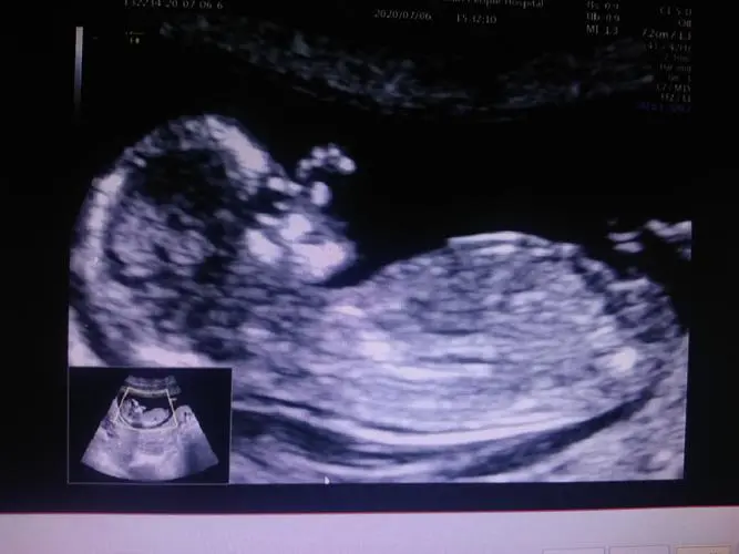 NT三个亮点是男孩女孩 NT三个亮点是男孩女孩