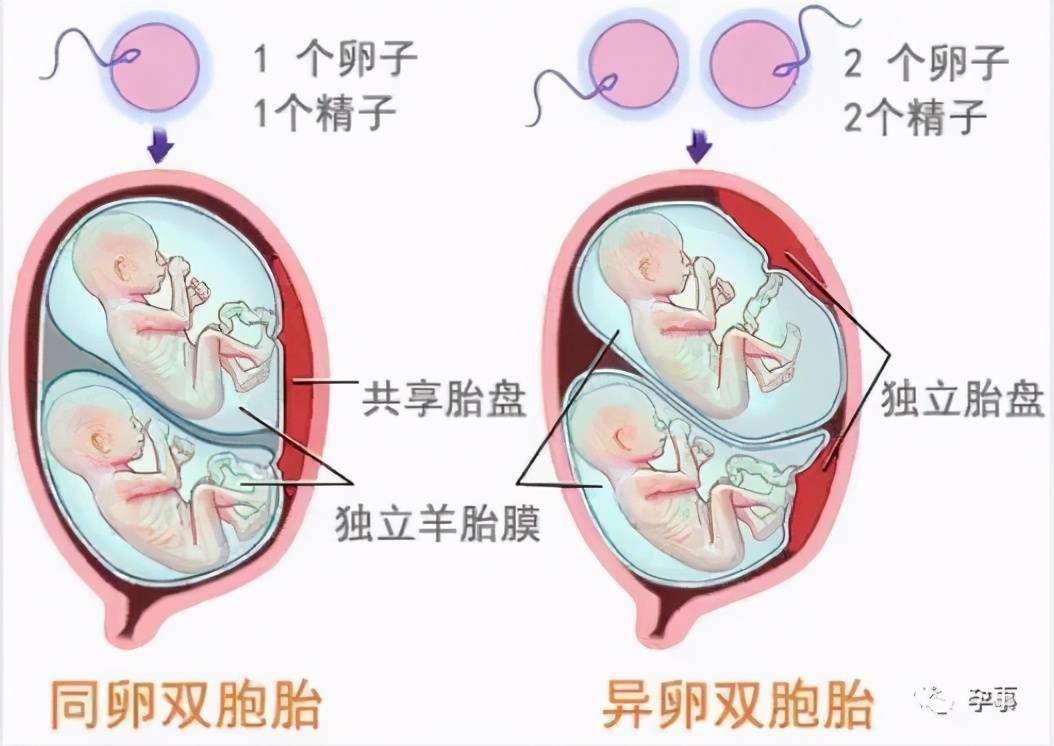 什么叫做异卵双胞胎，它和同卵双胞胎有什么区别