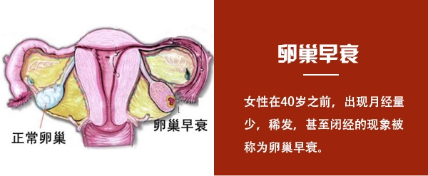 卵巢早衰的八大征兆，这些都表现的十分明显