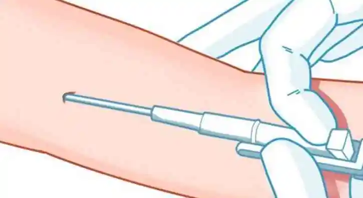 打避孕针一针有效期是多久？附相关价格介绍