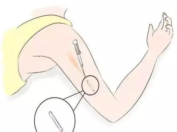 打避孕针一针有效期是多久？附相关价格介绍