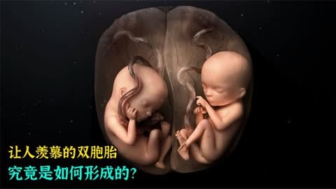 普通人自然怀上双胞胎是怎么形成的由谁决定的