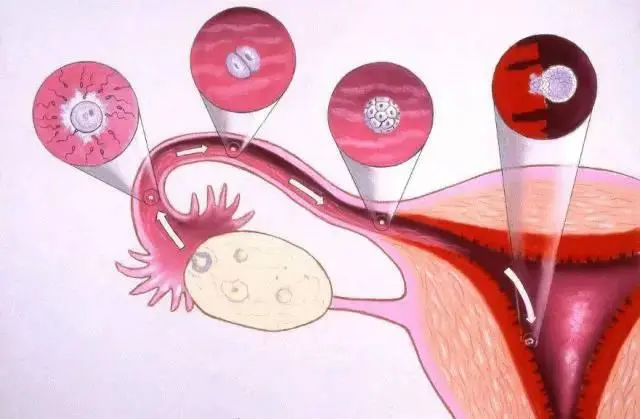 掌握四个小妙招让子宫内膜薄的你快速恢复过来