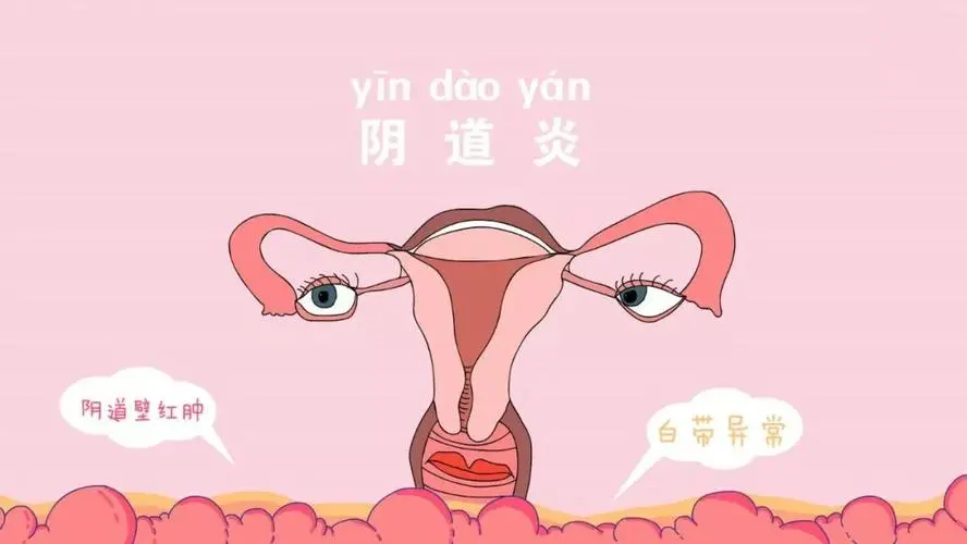 同房后用纸擦有淡红色血竟然与这三种原因息息相关