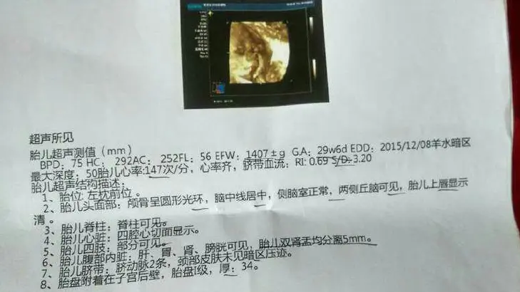 b超单可以告诉你胎儿的性别，只要有这个一般是男孩