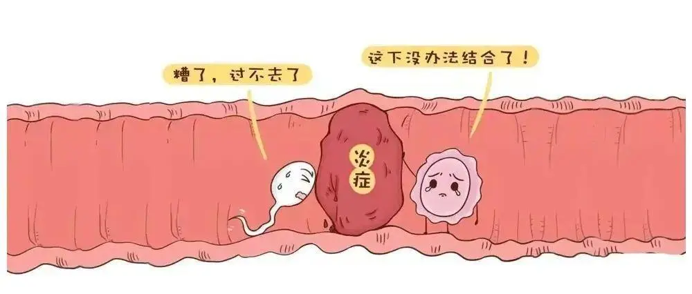 身体出现这十个症状说明你的输卵管堵塞了