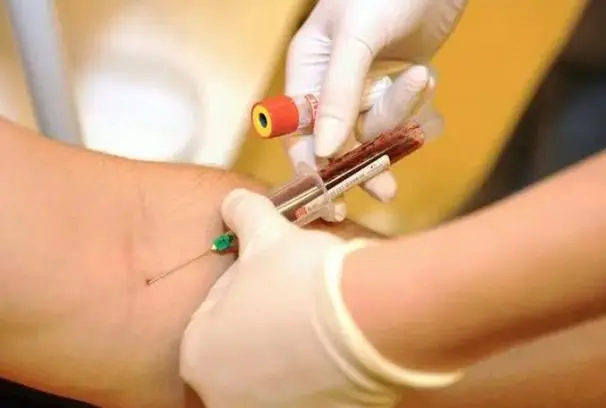 怀孕之后可以去香港验血查男女吗，准确率高不高