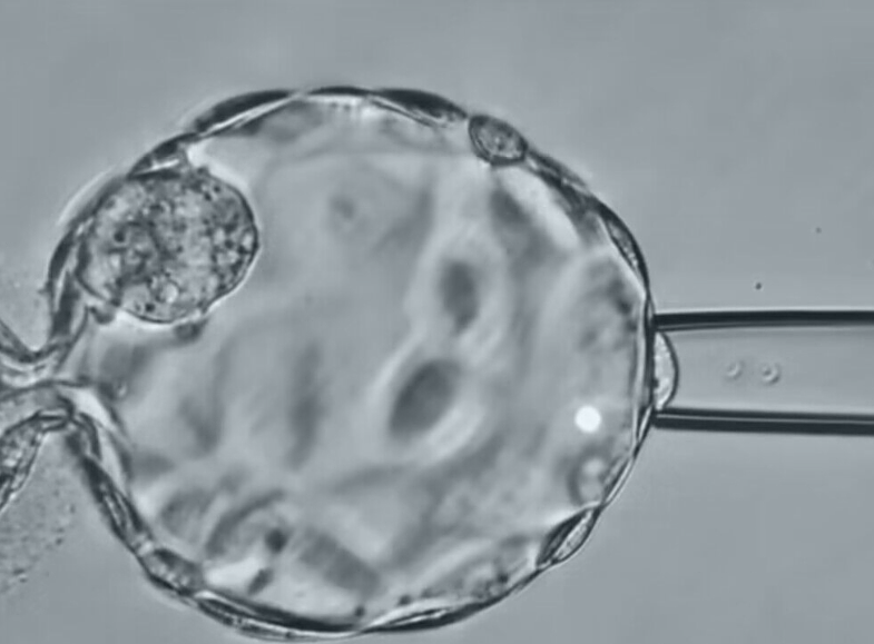 在广州三代试管助孕生子要花费多少钱？