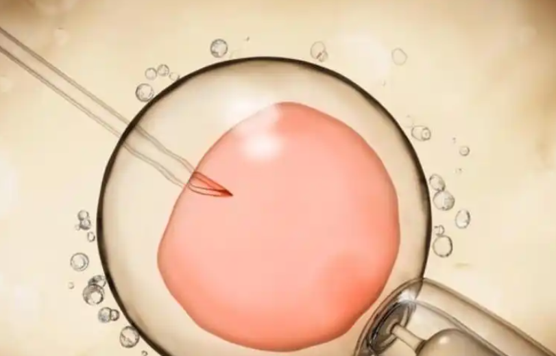 2026年国内第三方三代试管婴儿助孕的费用要多少钱？