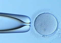 做试管婴儿免疫全套检查是什么来的？