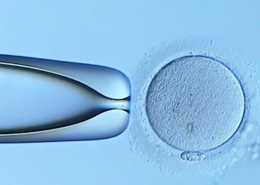 做试管婴儿免疫全套检查是什么来的？