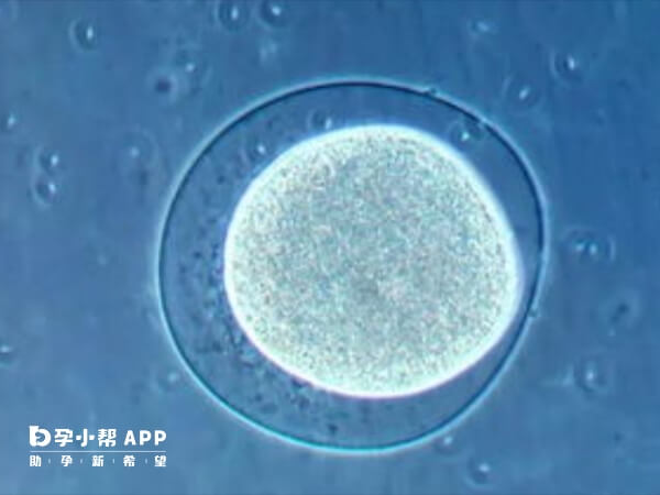 试管移植后出现耳鸣可能是多种原因导致的