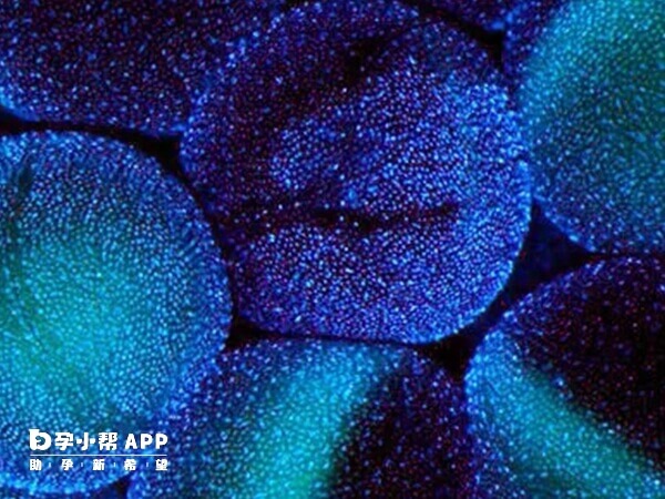 贺美奇是试管常用促排药