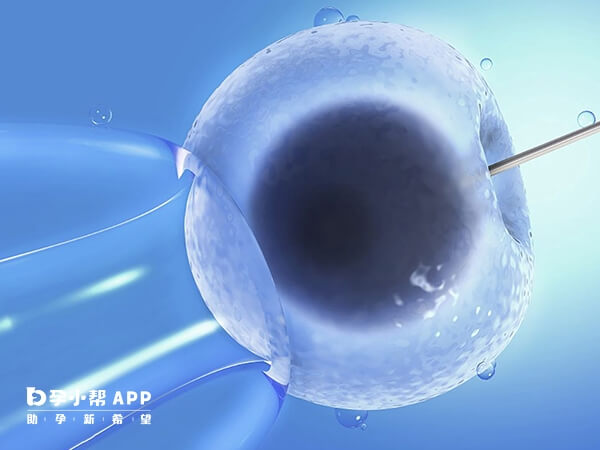 二代试管专为解决严重男性不育