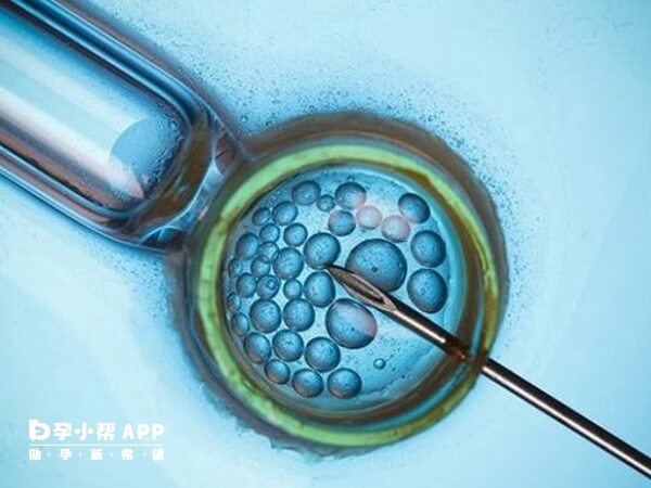 夫妻都无法提供基因不算亲生