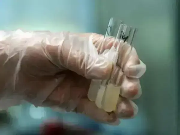 附睾抽吸精子适用于射精困难的人