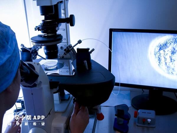 试管婴儿技术本身不能直接筛查咖啡斑