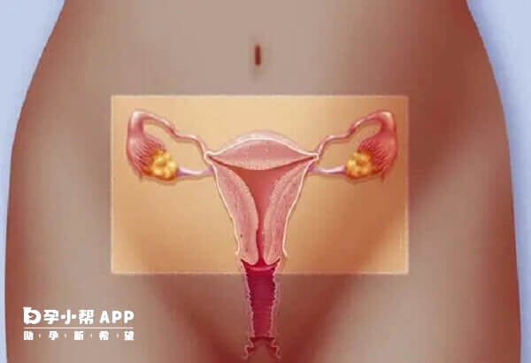 子宫内膜不好的患者用来曲唑比克罗米芬好