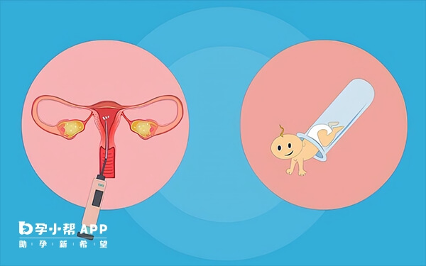 优质胚胎是着床成功的基础