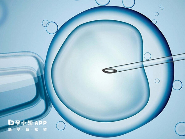 国内尚未全面放开HIV阳性女性的试管应用