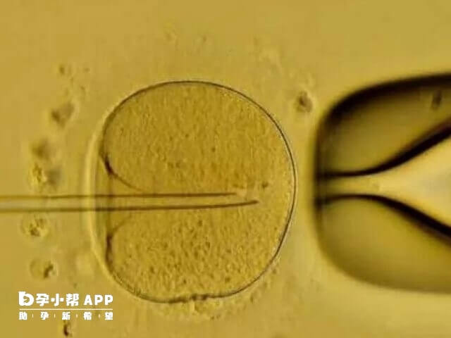 漏斗胸的成因较为复杂