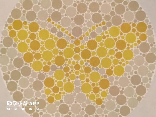 遗传性三尖瓣下移畸形可通过三代试管避免