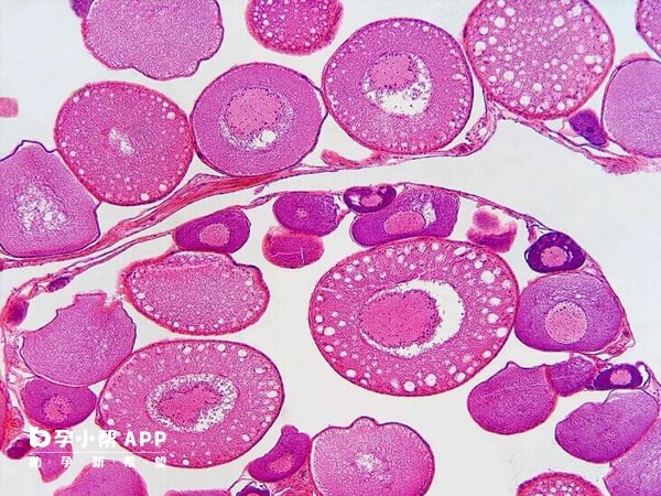 月经第四天是可以去医院定方案的