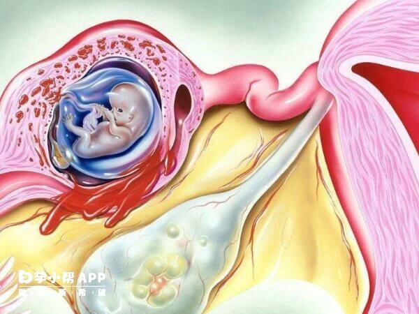 试管移植第三天出血跟着床有关系