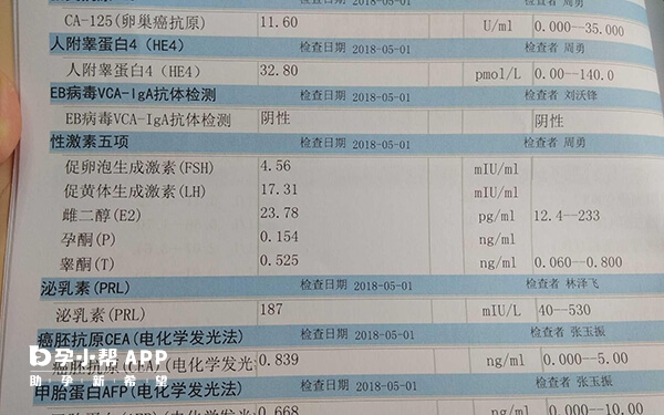 性激素六项临床意义各有差异