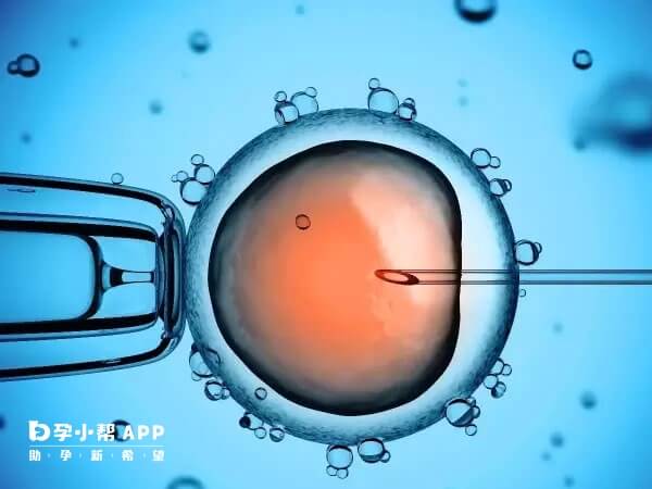 试管婴儿的条件很严格