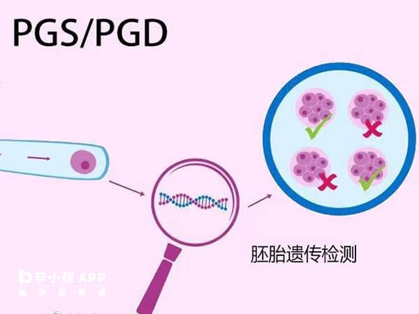 三代试管技术可筛查染色体异常