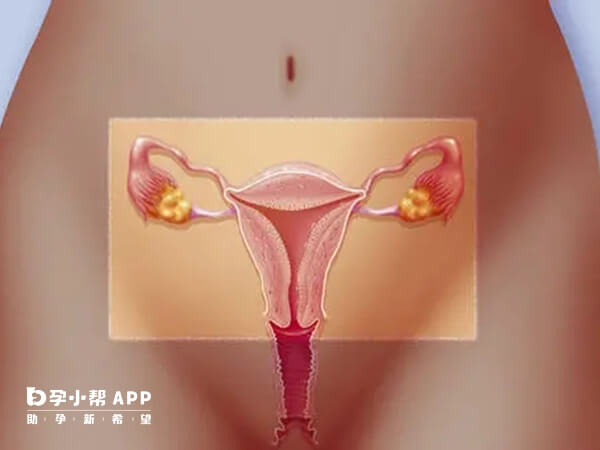 排卵前疼痛多发生于腹的一侧