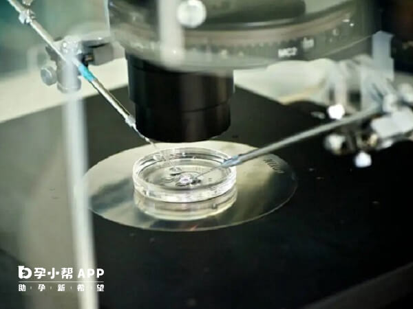 ivm和ivf也广泛应用于临床实践中