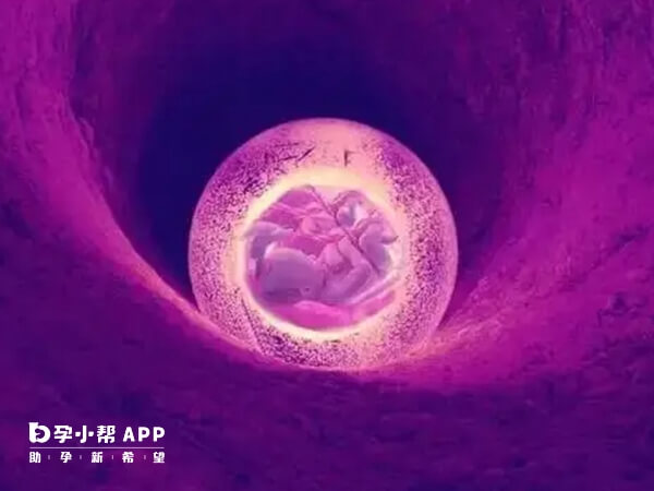 试管取卵后子宫增大可能与取卵操作有关