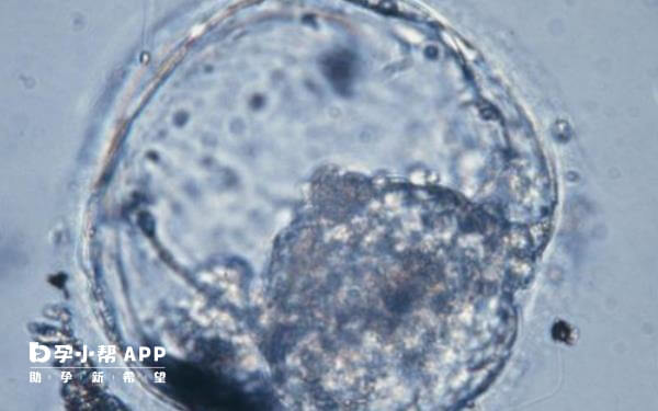 试管婴儿胚胎822属于二级胚胎