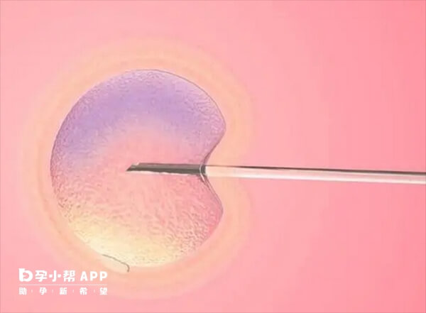 取卵针取卵有三个主要步骤