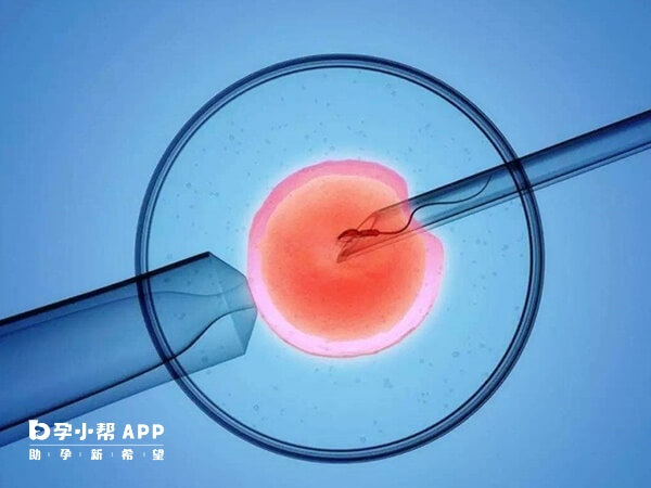 做显微取精的手术前要进行全面检查