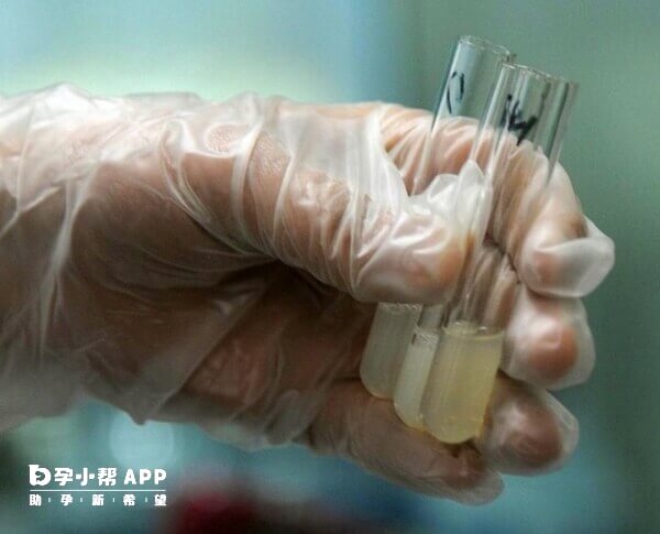HIV患者做人工授精费用在1.5万-2万左右