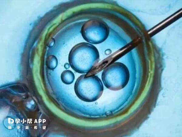 试管移植后盗汗注意保持积极乐观的心态