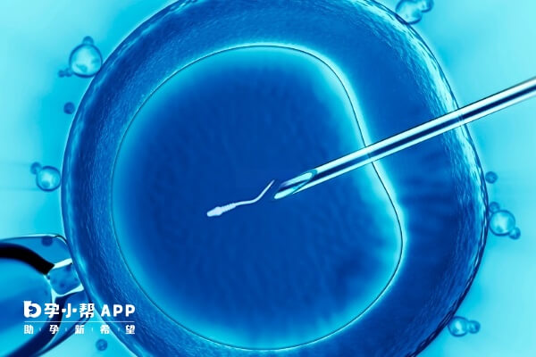 试管方案的选择需结合个人身体状况