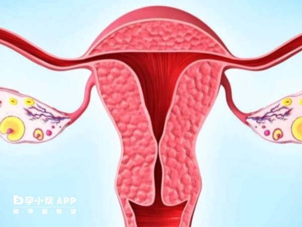 性生活中的刺激可能诱发卵巢扭转