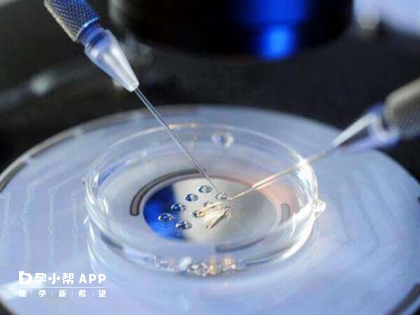 国内公立试管婴儿医院通常采用流水线模式